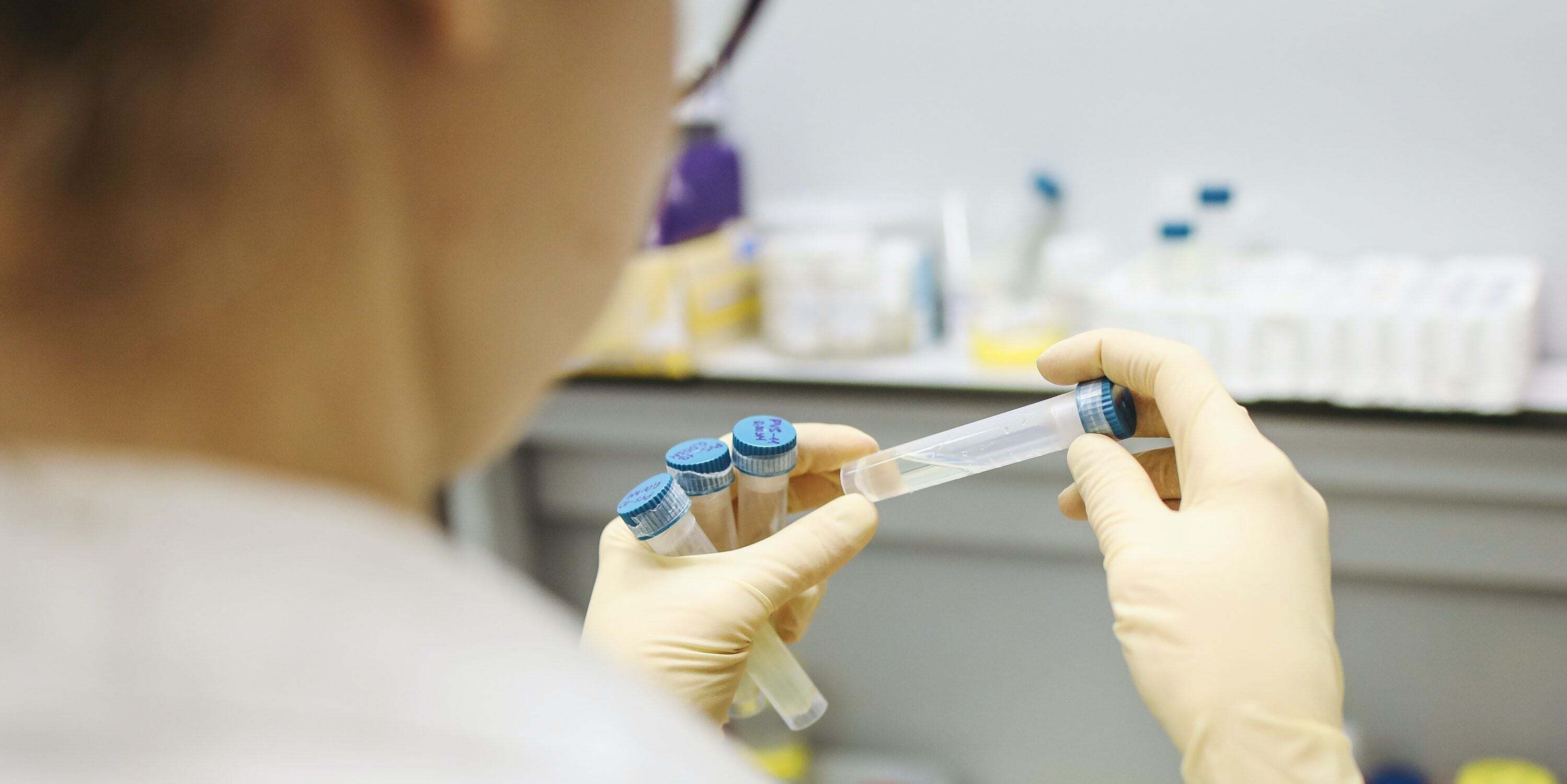 Crean en Chile kit olfativo para detección rápida del Covid 19
